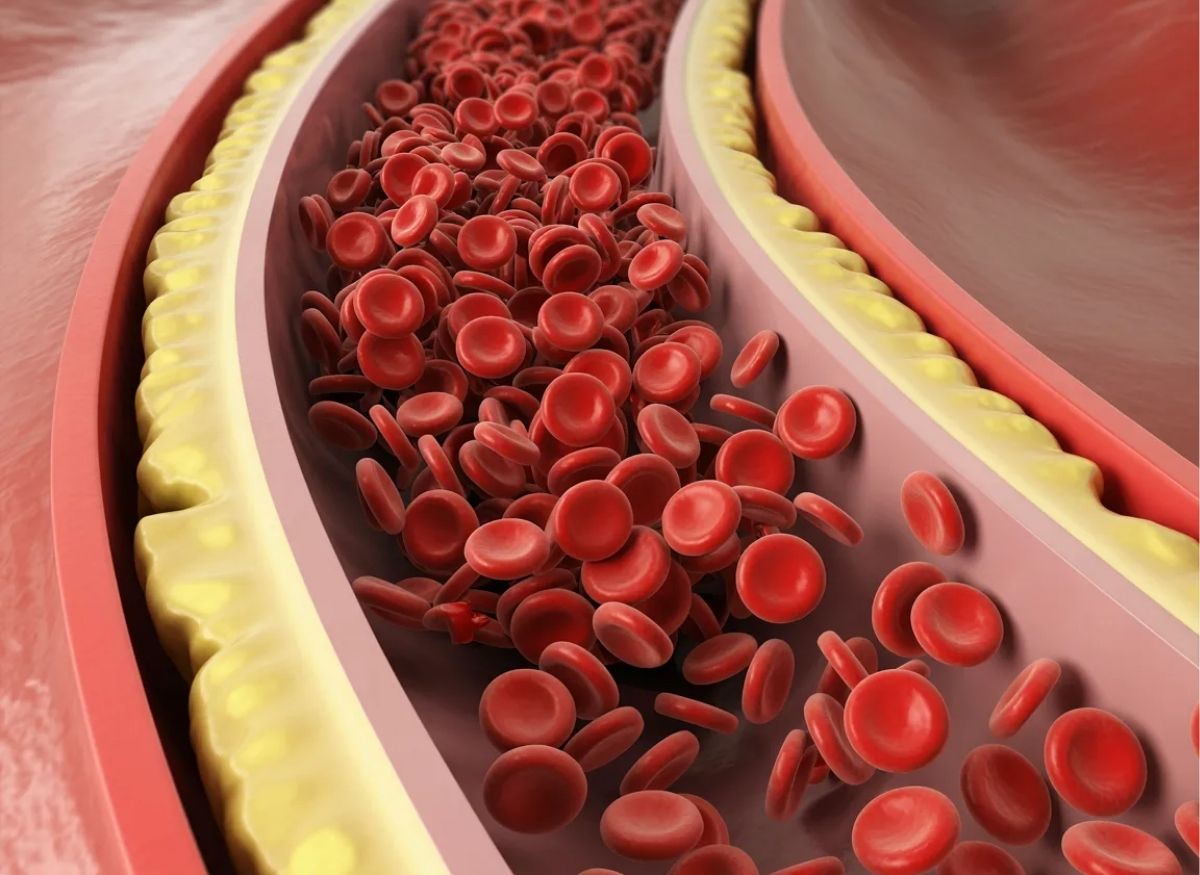 6 Symptoms of Elevated Red Blood Cells You Should Know - Trendy Tips